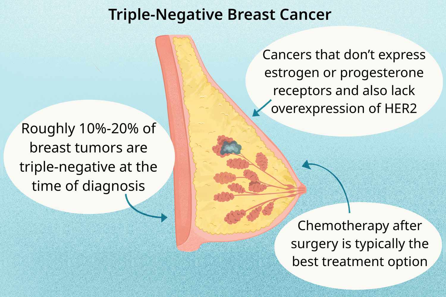 <strong>“Unveiling Breast Cancer: Recognizing Early Warning Signs and Symptoms for Proactive Health”</strong> post thumbnail image